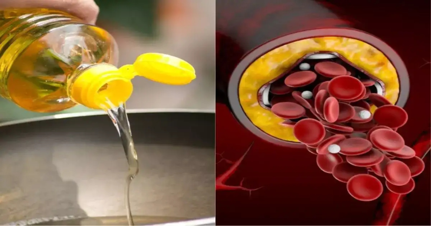 To Get Rid of Cholesterol, Eat This Oil in Vegetables – The Effect Will Be Seen Soon